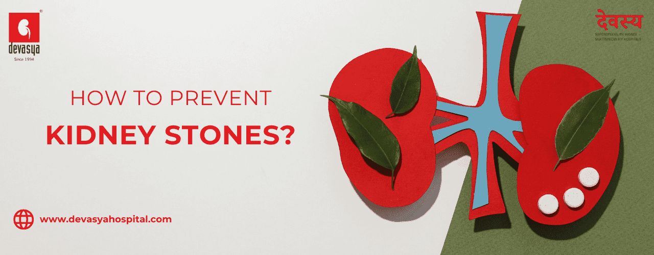 Kidney stone prevention tips with water, healthy diet, and lifestyle habits