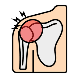 /uploads/Rotator_Cuff_Tear_875d4d0c92.png
