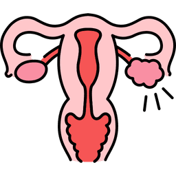 /uploads/ocarian_cyst_bb98c9eadd.png