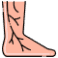 /uploads/varicos_veins_4911f8203f.png