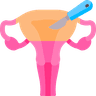 uterus removal.png